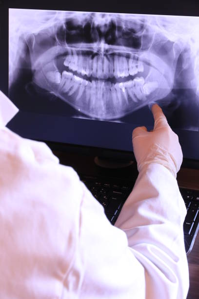 Best Emergency Wisdom Teeth Removal in Wilton Center, CT